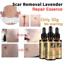 30g Lavender Essence Scar Repair Skin Essential Oil Natural Pure Remove Ance Burn Strentch Marks Scar Removal 2024 - buy cheap