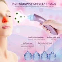 Blackhead Remover Vacuum Pore Cleaner Face Cleaning Blackhead Acne Removal Suction Black Spot Cleaner Facial Care Tool Skin Care 2024 - buy cheap