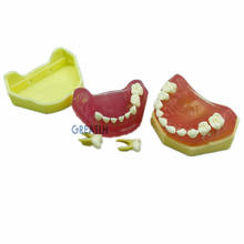 Dental Soft Gum mini Typodont Study Model with Removable Teeth Model Dental Supplies 2024 - buy cheap