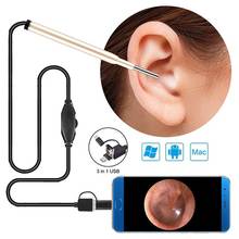 3.9mm Otoscope Ent Inspection Camera Video 3 in 1 USB Visual Ear Cleaning Endoscope 720P Medical Camera for Android Phone PC 2024 - buy cheap
