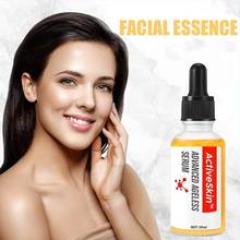 ActiveSkin Advanced Serum Anti Remove Care Dark Spots Anti-aging Whitening Face Serum Skin Essence R4E1 2024 - buy cheap