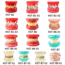 Modelo de dentes ortodônticos dentais, modelo de estudo de cuidados bucais, modelo para comunicação de paciente para sua escolha 2024 - compre barato