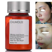 Chumolee-crema facial blanqueadora con polvo de Ácido Kójico 99% puro, elimina pecas, Melasma, acné, cicatrices, pigmento, melanina, Sopts oscuros, cuidado facial 2024 - compra barato