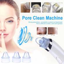 Facial Skin Care Acne Blackhead Remover Beauty Face Skin Care Tool Vacuum Suction Pore Clean Machine Facial Pore Cleaner Machine 2024 - buy cheap