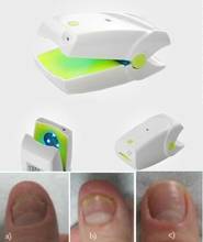 Nail Cleaning Laser Device Professional Safe, Quick and Painless Nail Fungus Treatment for Toe and Finger Nails 2024 - buy cheap