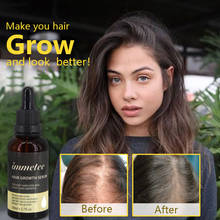 Эссенция для роста волос, масло, эффективный экстракт, против выпадения волос, питательное средство для лечения корней волос, средство для ухода за волосами 2024 - купить недорого