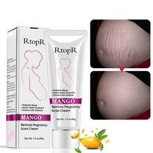 RtopR Mango Stretch Mark Cream Natural Mild Non-irritating For Remove Pregnancy Scars Acne Cream Repair Anti-Aging Anti Winkles 2024 - buy cheap