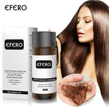 EFERO Hair Growth Essence Preventing Hair Loss Product Hair Care Dense Hair Fast Restoration Growth Serum Beard Essential Oil 2024 - buy cheap