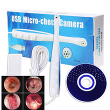 Câmera intraoral dental usb com 6 leds, luz multifuncional, orelha nariz ent câmera médica otoscópio endoscópio 2024 - compre barato