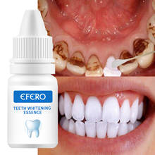 EFERO Teeth Whitening Essence Powder Clean Oral Hygiene Whiten Teeth Remove Plaque Stains Fresh Breath Oral Hygiene Dental Tools 2024 - купить недорого