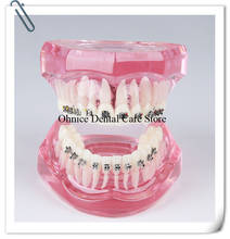 Modelo de dentes ortodônticos dentais, cabo bucal com suporte, modelo de dentes para prática ortodôntica dental, tubos bucal para molares 2024 - compre barato