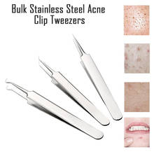 1PC Stainless Steel  Blemish Extractor Tool For Remove Comedones Blackhead Acne Pimple Tools 2020 2024 - buy cheap