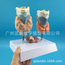 Human thyroid pathology Hyperthyroidism anatomical model Thyroid tumor medical model 2024 - buy cheap