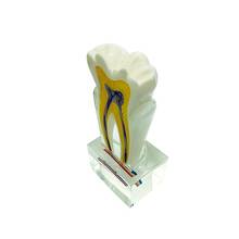 Dentistry Product 6 Times Tooth Model with Nerves Dental Teeth Model Teaching Model 2024 - buy cheap