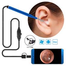 3.9mm Lens Smaller HD Ear Cleaning Endoscope Camera Android USB Endoscope Skin Pore Nose Check Inspection Mini Camera 2024 - buy cheap