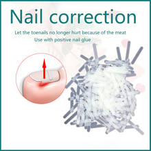 10Pcs Ingrown Toenail Correction Tool Nail Treatment Elastic Patch Sticker Straightening Clip Brace Pedicure Tool 2024 - buy cheap
