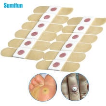 12pcs Foot Plaster Corn Removal Pads Medical Plasters Warts Thorn Patch Curative Patches Calluses Callosity Detox Foot Patches 2024 - buy cheap