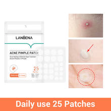 LANBENA Day-Parche de granos de acné, pegatinas invisibles para el tratamiento de imperfecciones, removedor de granos de acné, herramienta de belleza para el cuidado de la piel 2024 - compra barato