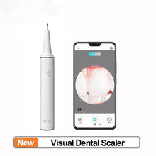 New xiaomi SUNUO Smart Visual Ultrasonic Dental Scaler500W HD Endoscope IPX7 Waterproof Three Cleaning Modes Oral Clean With App 2024 - buy cheap