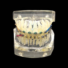 1PC Dental Orthodontic Study Teaching Model Teeth Orthodontic With Colorful Brackets for Neat and misaligned models choose 2024 - buy cheap