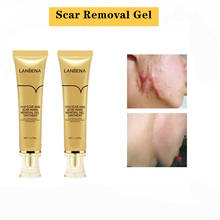 Acne Scar Removal Cream Scar Gel Skin Repair Face Cream Acne Spots Acne Treatment Care WhiteningCare WhiteningStretch Marks2pcs 2024 - buy cheap