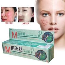 Chinese Natural Herbal Remove Acne Cream Germicidal Remove Mite Moisturizeing Acne Treatment Ointment Cream Skin Care 18g 2024 - buy cheap