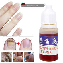 Nail Cuticle Oil Repair Fungal Nail Treatment Remove Toe Onychomycosis Remover Serum Nail Repair Treatment for Health Skin Care 2024 - compre barato