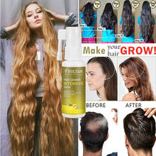 Spray de perda de cabelo 30ml, essência para crescimento capilar, cuidado para o cabelo, gengibre, essência para tratamento de perda prevenção de cabelo 2024 - compre barato
