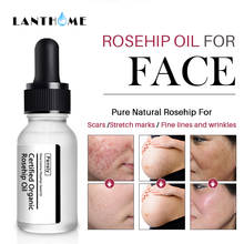 Rosehip Oil Organic Moisturizer Anti Aging Essential Oil Face Skin Care Massage Heal Dry Skin Fineline Wrinkle Stretch Mark 10ml 2024 - buy cheap