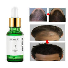 Hot sale Shouwu Hair Growth Essence Oil Hair Loss Treatment Help for hair Black hair Thick hair Growth Hair Care 20ml 2024 - buy cheap