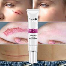 RtopR-Crema para eliminar cicatrices y acné, crema facial reparadora para el cuidado de la piel, tratamiento para puntos negros y acné 2024 - compra barato