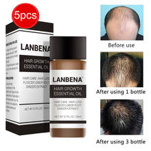 Эссенция для роста волос LANBENA, 20 мл, быстрое мощное средство для ухода за волосами, эфирное масло, жидкое лечение, для предотвращения выпадения волос для мужчин и женщин 2024 - купить недорого