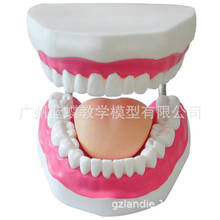 New Dental Model Teeth Implant Restoration Bridge Teaching Study Medical Science Disease Dentist Dentistry Products 2024 - buy cheap