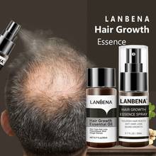 Спрей LANBENA для роста волос, спрей для проращивания и предотвращения облысения, питает корни волос, уход за волосами для мужчин и женщин, 2 шт. 2024 - купить недорого