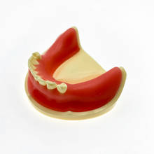 Práctica de implantes dentales para la práctica de perforación de pulsaciones, s, estudio Dental, enseñar modelos de dientes 2024 - compra barato