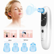 5 Suction Blackhead Remover Device Anti Wrinkles Acne Dead Skin Pimple Removal Tool Pore Vacuum Beauty Home SPA Skin Care Device 2024 - buy cheap