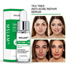 MSLAM Natural Tea Tree Extract  to Remove And Desalinate Acne Repair  Facial Care Serum 15ml 2024 - buy cheap