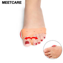 Meetcare Forefoot Silicone Gel Sleeve Hallux Valgus Correction Thumb Orthopedic Braces Big Toe Eversion Crossbow Feet Pain Care 2024 - buy cheap