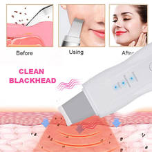 Limpiador Facial no ultrasónico, recargable por USB, limpieza Facial profunda, cuidado de la piel, masaje de vibración, elimina la suciedad, exfoliación Facial 2024 - compra barato