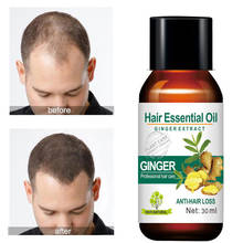 MOKERU имбирь органические травяные волосы эфирное масло лечение выпадения волос эссенция для быстрого роста волос продукты выпадения волос 30 мл 2024 - купить недорого
