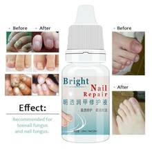10ml Anti-fungal Cuticle Oil Nail Repair Treatment Growth Fungi Oil Strengthen Nai Toenail Mint Manicure Fungus Nail Bright B7C9 2024 - buy cheap