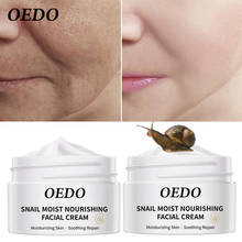 2PCS Snail Essence Skin Care Face Cream Serum Whitening Anti-wrinkle Anti Aging Hydrating Moisturizing Facial Creams Cosmetics 2024 - buy cheap