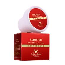 Stretch Marks Removal Skin Repair Body Cream skin care,smooth Natural Essence Repair Cream For Pregnancy Pro 2024 - buy cheap