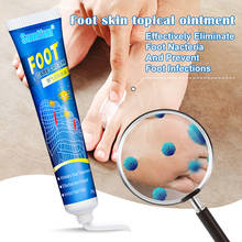 Anti Fungal Infections Foot Cream for Athlete's Foot Pain Relief Beriberi Itch Erosion Peeling Blisters Feet Ointment A7 2024 - buy cheap