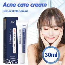 Crema facial para el cuidado del acné, crema reparadora para puntos negros para aliviar el enrojecimiento, controlar los poros y eliminar el acné, 30g 2024 - compra barato