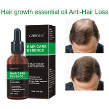 New Hair Growth Essence Oil Hair Growth Oil Products Essential Oil Treatment Hair Loss Hair care, Powerful hair, Hair & scalp Treatment 2024 - buy cheap