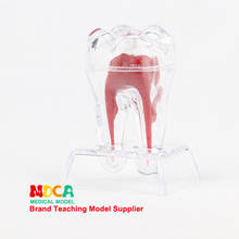 Dente anatômico modelo dental acessórios removíveis decoração do dente material oral 2024 - compre barato