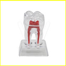 Стоматологическая кристальная основа для зубных зубов из твердого пластика, Молярная Модель, разделяемая 2024 - купить недорого