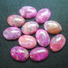 10pcs nature gem stone cabochons oval shape 18x25mm malachite stone beads pink colors diy beads accessories 2024 - buy cheap