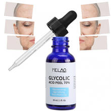 Improve acne skin nourish and brighten skin tone balance water oil 30% glycolic acid peel 70% serum repair solution shrink pores 2024 - buy cheap